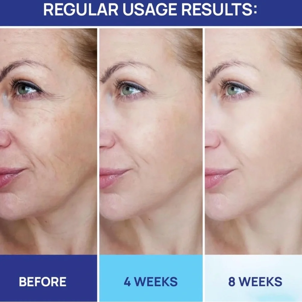 Moonrin Retinol & Collagen Moisturizer Cream with Hyaluronic Acid 1.8 Oz - Picture 6 of 6